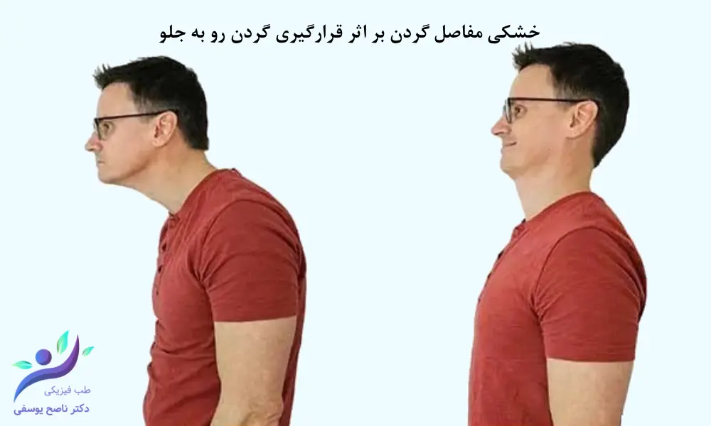 خشکی مفاصل گردن