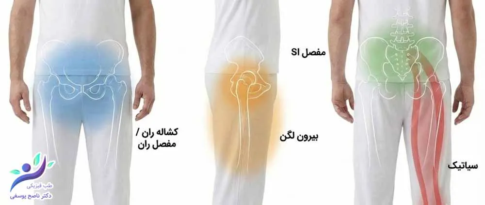 الگو